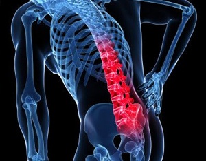 Poor posture in forward bend puts pressure on the discs and vertebra of the spine